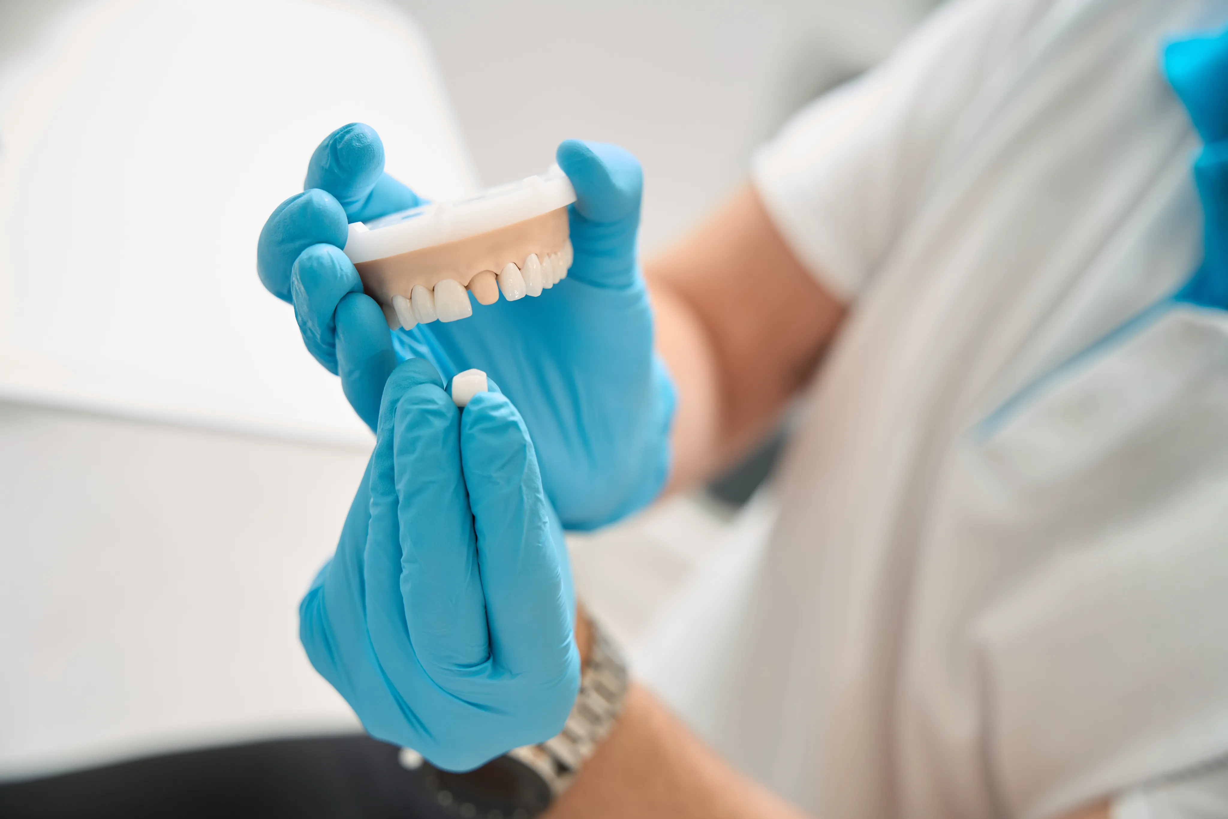 Same-Day CEREC Crowns